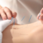 Unveiling the Truth About Acupuncture
